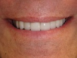 compare 1 after dentist in regina cosmetic dentistry
