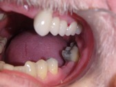 compare 3 after dentist in regina best cosmetic dentistry