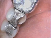 compare 3 before dentist in regina cosmetic dentistry