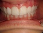 compare 4 after dentist in regina, SK, the best cosmetic dentistry