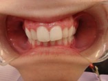 compare 4 before dentist in regina, SK, the best cosmetic dentistry